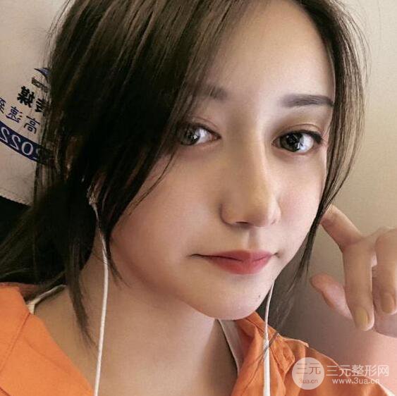 廣州名韓醫(yī)療美容卓敬錫“隆鼻整形+自體脂肪填充全臉”案例分享，整完有點像景甜