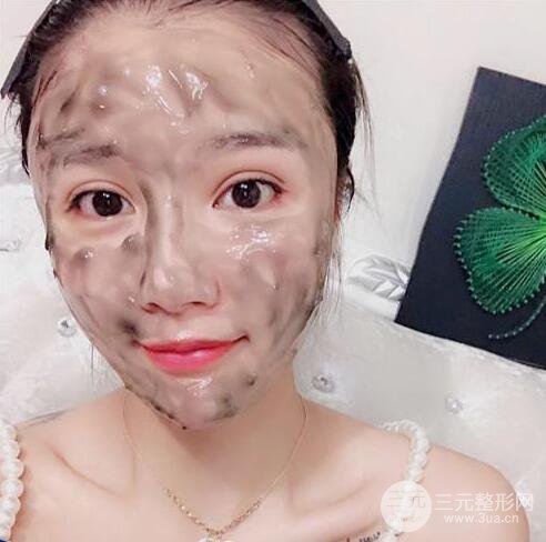 辣媽做了自體脂肪填充全臉，對比圖分享