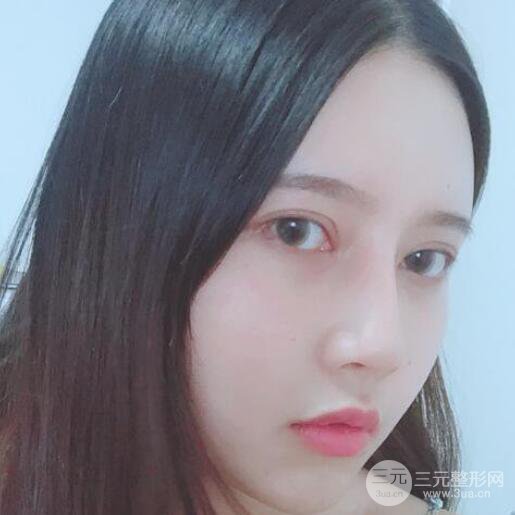 宜昌美岸醫(yī)療美容李英華自體脂肪面部填充怎么樣？真人日記曝光
