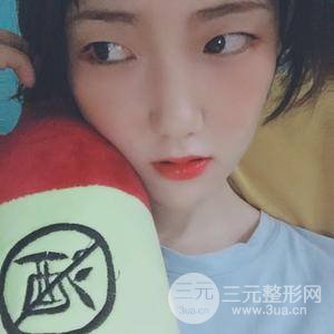 雙眼皮三個(gè)月果恢復(fù)圖