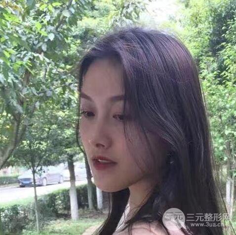 做了“埋埋蛋白線.提升+隆鼻整形”，恢復(fù)后老公說(shuō)很沒(méi)有降低風(fēng)險(xiǎn)感