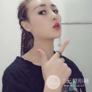 進(jìn)口假體+肋軟骨墊鼻尖三個月果恢復(fù)對比圖