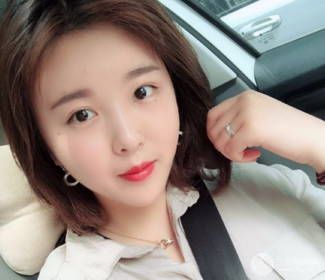 面部光纖溶脂三個月恢復(fù)記錄，妹子終于擺脫大臉盤子辣