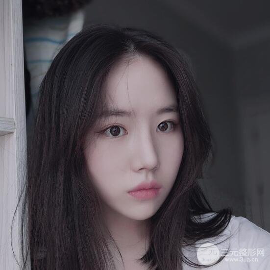 上海華美醫(yī)療美容李庭勛膨體隆鼻怎么樣？果對比圖