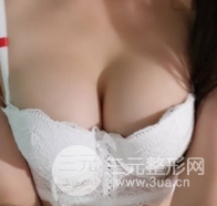 自體脂肪隆胸恢復(fù)圖曝光，見證從A到C的蛻變
