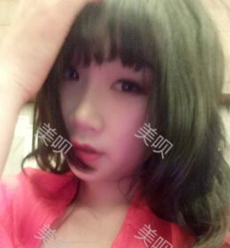 做了切開(kāi)雙眼皮之后氣質(zhì)都不一樣了