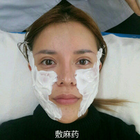 埋蛋白線.提升面部對比圖片，顏值嘩嘩嘩的往上漲!!!