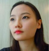 和大家分享北京301醫(yī)院做的下頜角整形真實經(jīng)歷