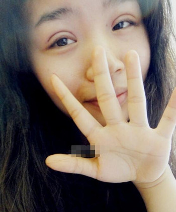 你們來看看藝美門智和做的埋線雙眼皮，瞬間變大眼美女