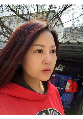 自體脂肪填充面部前后對(duì)比圖片，真的美了美了!