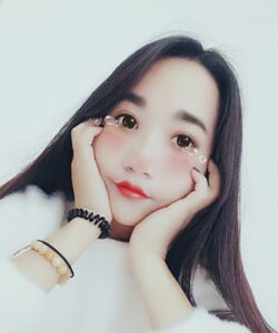 煙臺鵬愛魏璐做的全切雙眼皮，我也是大眼美女了