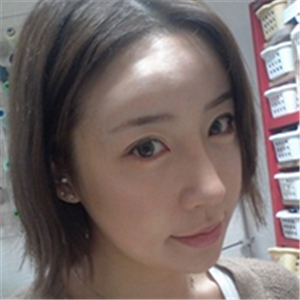 百*麗沈國雄做的隆鼻失敗修復(fù)，恢復(fù)果很好，還有前后對比照片！