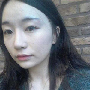 趙雅雄做下頜角整形成好嗎？看看我的前后對(duì)比圖片就知道了~