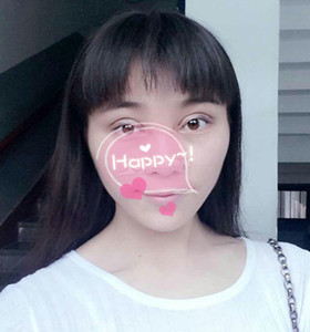 南京康美張讓虎醫(yī)生給我做的眼部綜合整形，大家來看看怎么樣