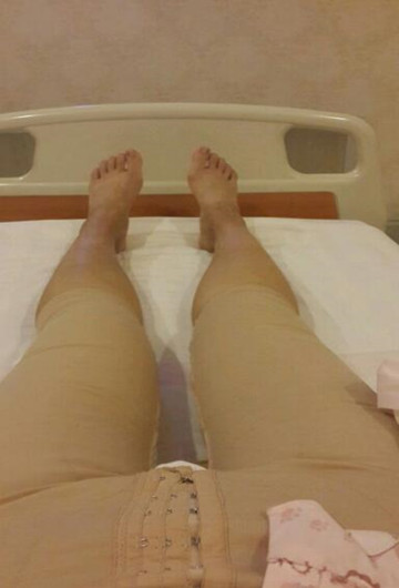 水動力吸脂瘦大腿讓我夏天放肆嗨