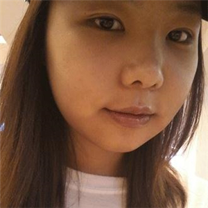 磨下頜角磨骨手術(shù)一個月了，分享一下恢復(fù)前后的果照片哇~