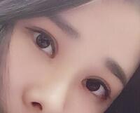 切開雙眼皮價格2680元，費用不貴果卻很好
