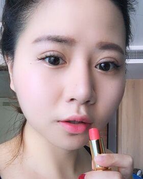 路衛(wèi)國給我做隆鼻整形后鼻子變得特別秀麗