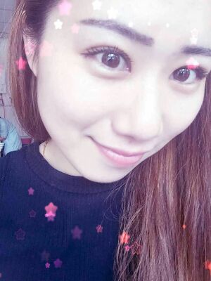 做了全切雙眼皮和開內(nèi)眼角，術(shù)后果較為滿意