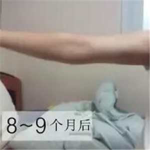手臂吸脂手術(shù)八個(gè)月了，看看我的前后對(duì)比果圖片吧~~