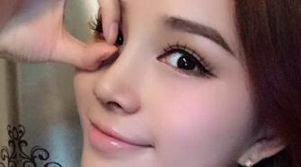 隆鼻整形后恢復圖