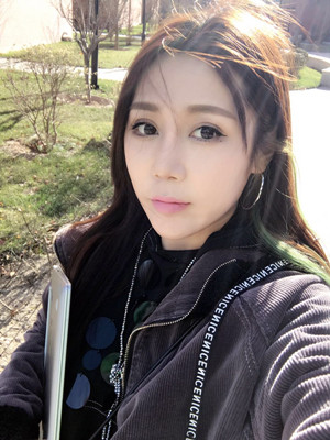 周長兵給我做的隆鼻整形恢復得好自然
