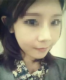 【20天康復(fù)記錄】隆鼻+面部脂肪填充，遇見更美的自己
