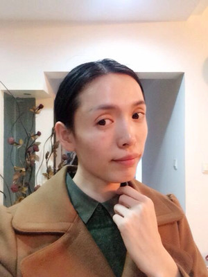 玻尿酸面部填充前后過程及對比圖片，來看看果如何