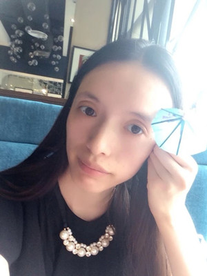 玻尿酸面部填充前后過程及對比圖片，來看看果如何