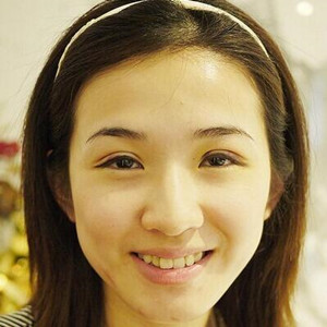 雙眼皮手術前后過程以及真實案例分享