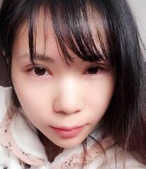 長(zhǎng)沙美之峰重瞼+開眼角恢復(fù)過(guò)程圖