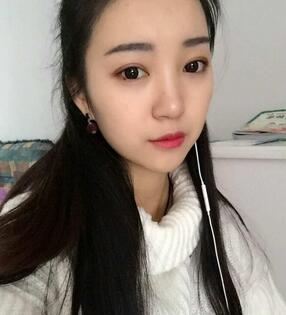 長(zhǎng)沙美之峰割雙眼皮3個(gè)月了
