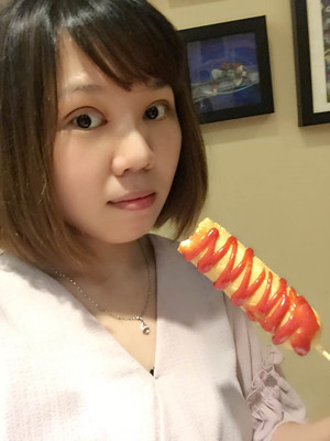 做了雙眼皮多項整形手術(shù)，大家來看看果如何