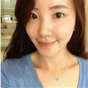 美女注射玻尿酸除皺過程分享，還有前后對比果圖片哦~