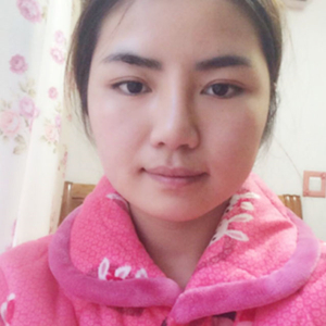 磨骨磨下頜角半年了，分享恢復過程和前后對比果照片哦~