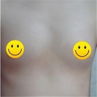 自體脂肪隆胸+副乳切除手術(shù)三個月了，曬一下恢復(fù)果照片~~