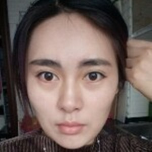 光纖溶脂去雙下巴臉型更好看了