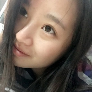 做了玻尿酸隆眉弓，感覺(jué)棒棒噠