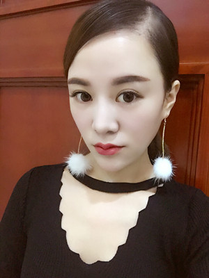 埋線面b提拉一個月之后還是美美噠