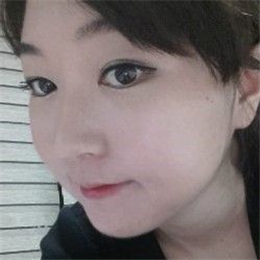 下頜角整形手術前后對比果圖片分享，還有恢復過程心路歷程~~~