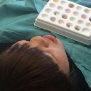 美容冠牙齒修復，緩解前后過程分享