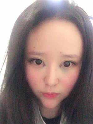 開了眼角之后，眼睛變得很勾人