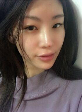 線D隆鼻恢復(fù)過(guò)程圖，看看我的果怎么樣
