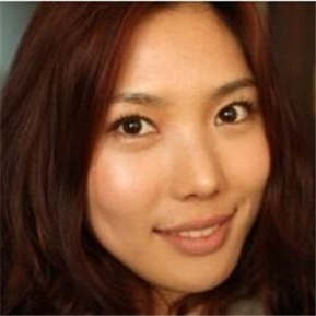 武漢希思特做了埋線法雙眼皮、開內(nèi)眼角和鼻尖移植軟骨整形手術(shù)~