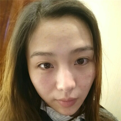 光子嫩膚和下巴脂肪填充術(shù)后果圖片分享，董萍門診做的~