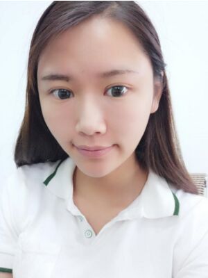 自體脂肪面部填充后恢復(fù)，成活率還蠻高的