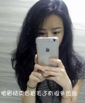 眉毛種植果和成長(zhǎng)過(guò)程分享