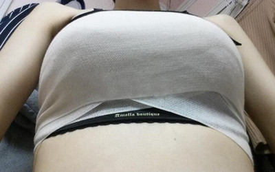 我的假體隆胸讓我從小平胸變深V 果還不錯