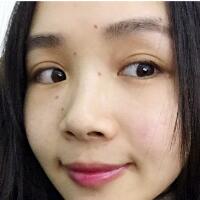 臉上激光去痣日志分享，一共去痣2次