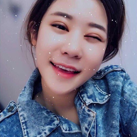 切開雙眼皮+開內(nèi)眼角手術前后過程，還有對比照片喲!